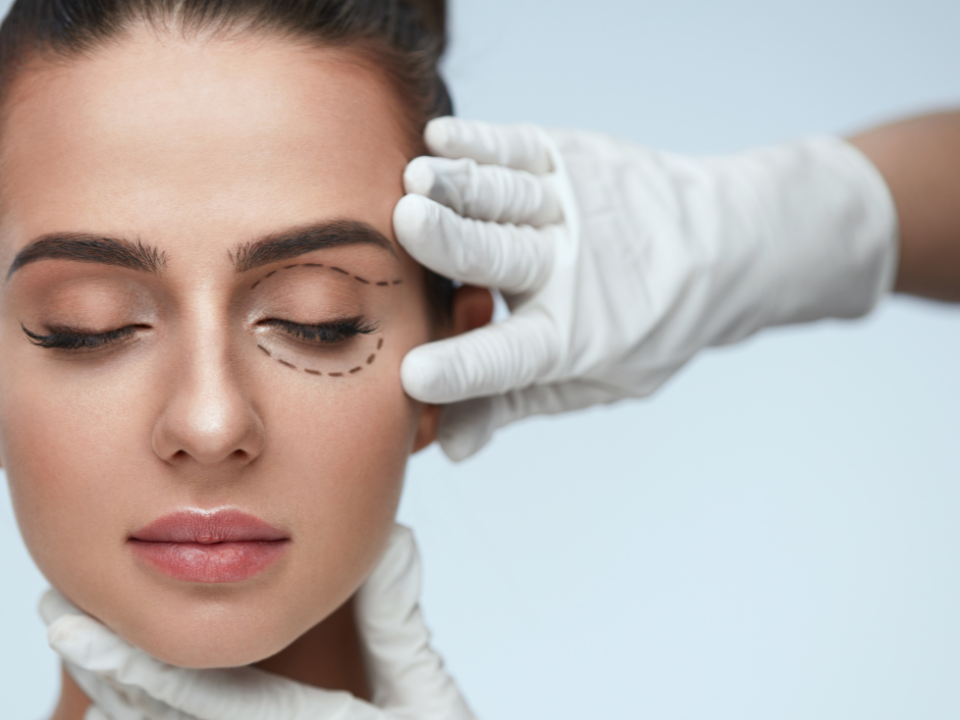 blefaroplastia é indicada